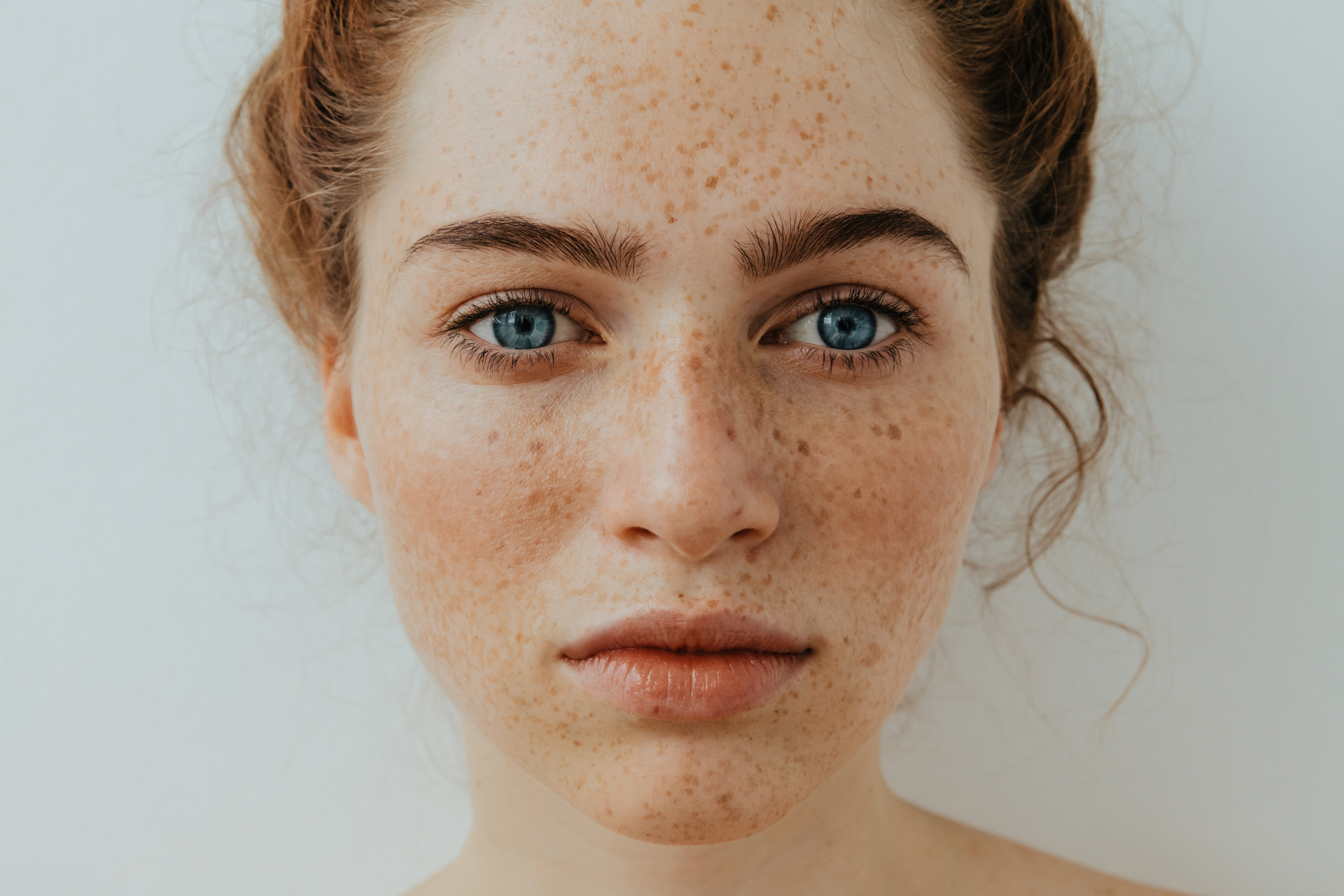 Skin Needling